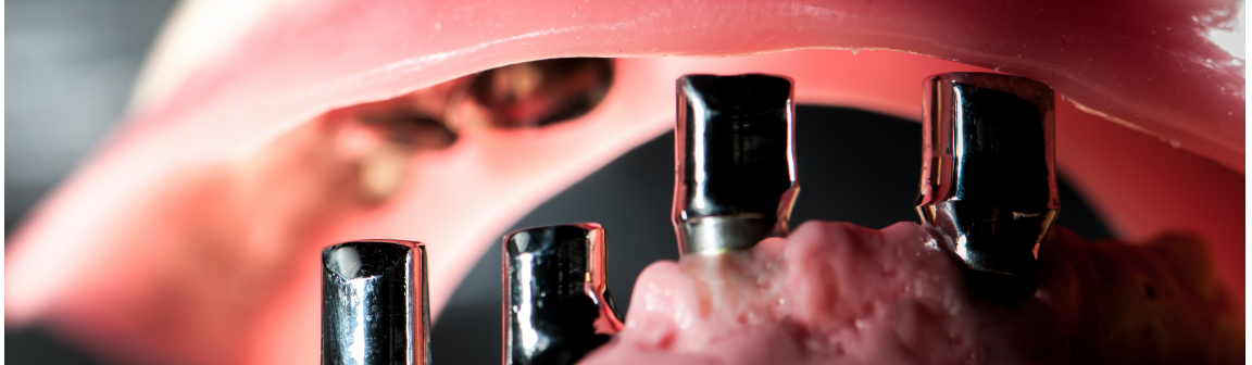 Zahnersatz, Bernd Wacker Dentallabor GmbH