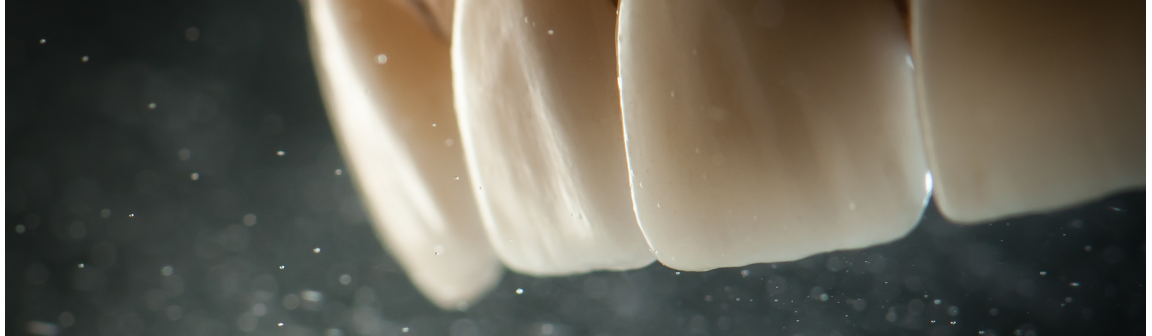 Zahnersatz, Bernd Wacker Dentallabor GmbH
