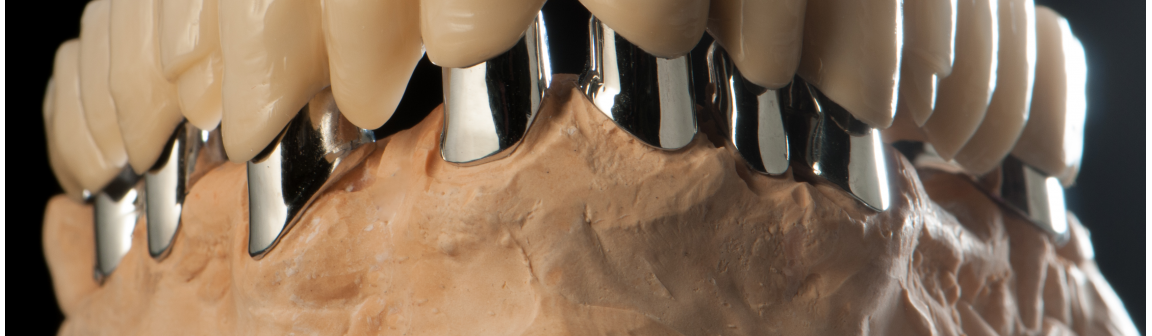Zahnersatz, Bernd Wacker Dentallabor GmbH