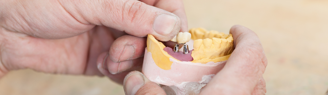 Zahnersatz, Dental-Labor Almut Richter