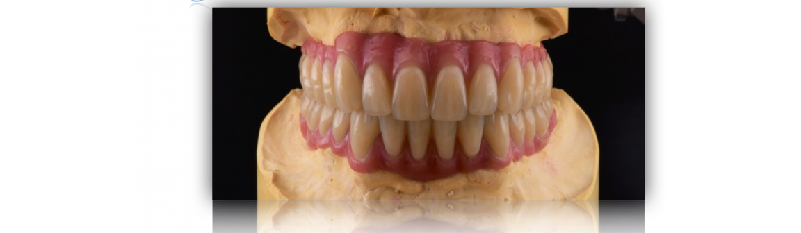 Zahnersatz, Die Zahnfee GmbH