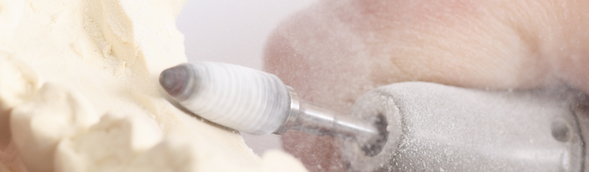 Zahnersatz, Hafkemeyer Zahntechnische Laborgesellschaft mbH