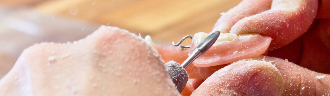 Zahnersatz, Hamacher-Dentallabor OHG