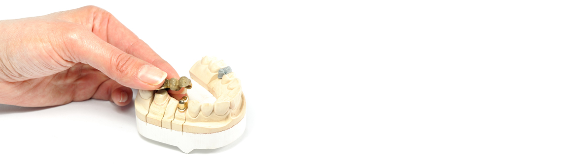 Zahnersatz, Matern Dental Zahntechnik