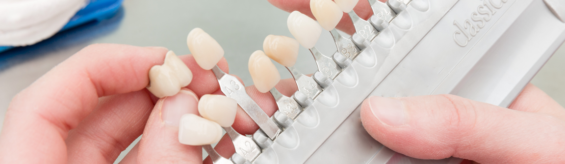 Zahnersatz, Zahntechnisches Meisterlabor Meyer Dental